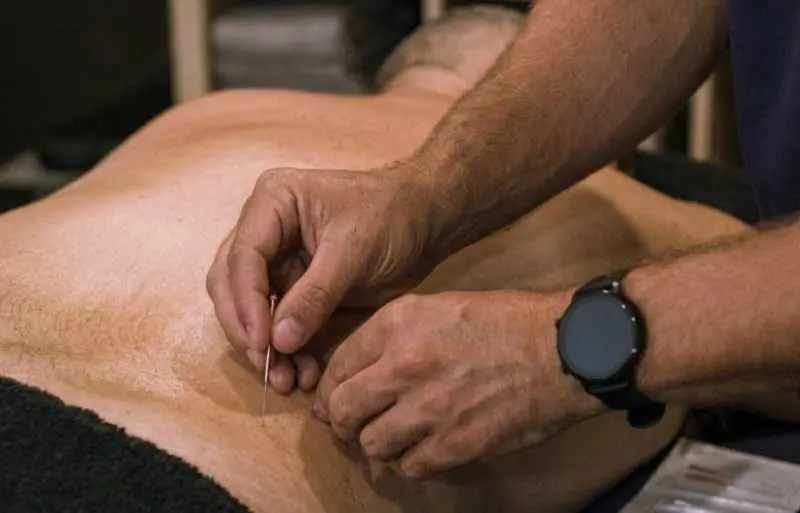 Acupuntura del dolor realizada por Adrián